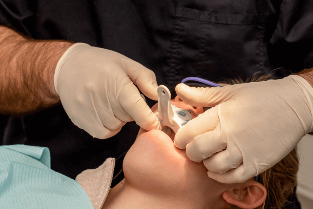 Descubra o passo a passo para fazer um molde para prótese dentária