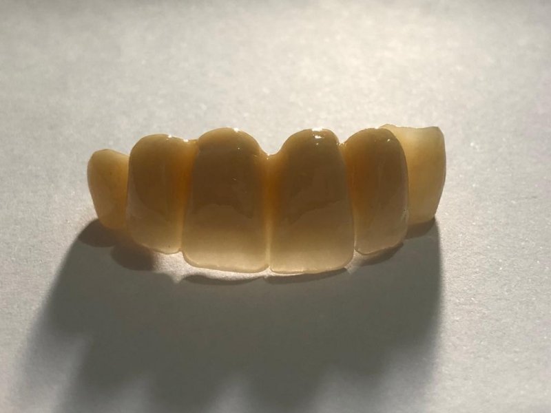 Provisórios (CAD/CAM) - Leme Laboratório