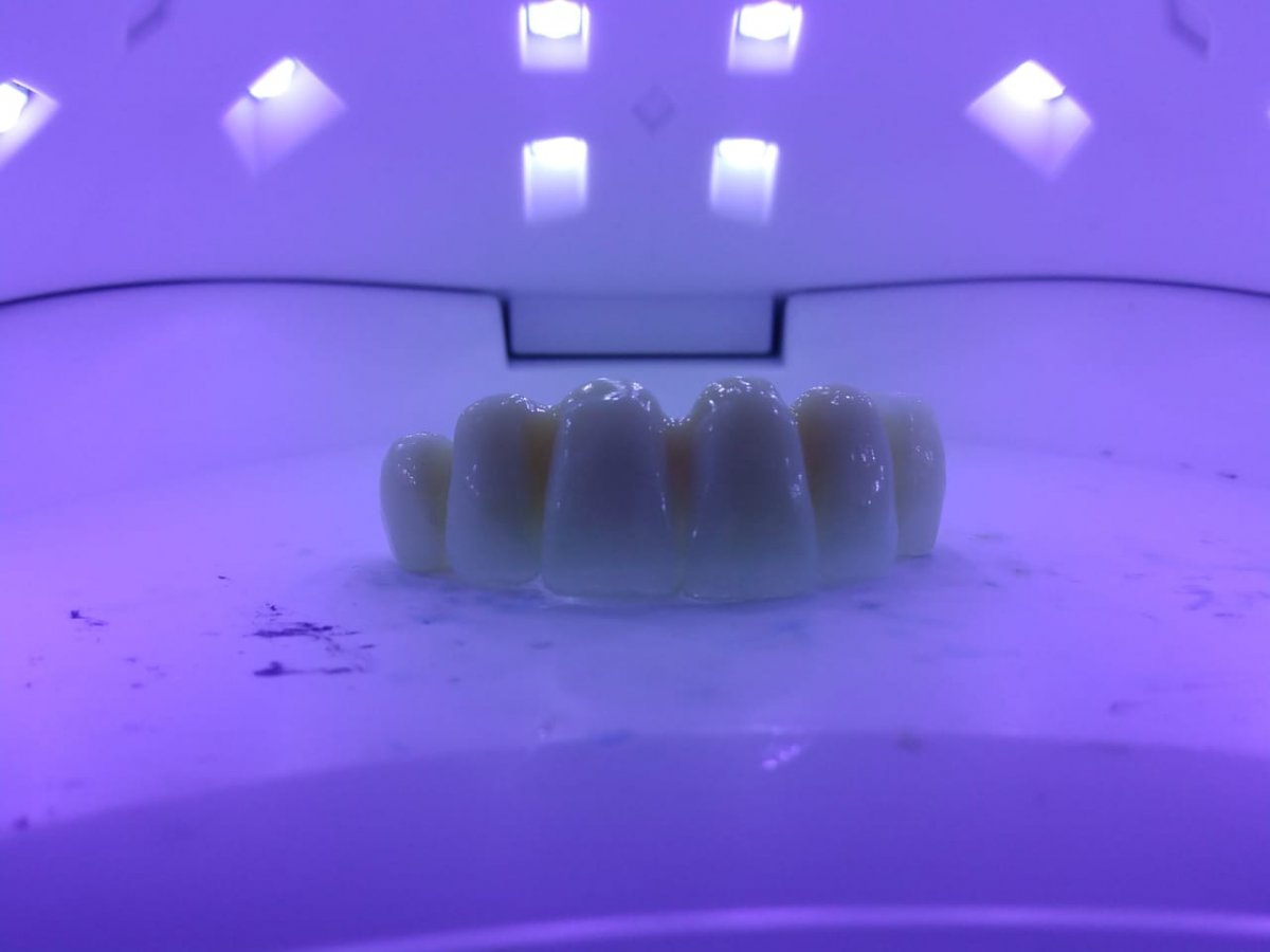 Provisórios (CAD/CAM) - Leme Laboratório