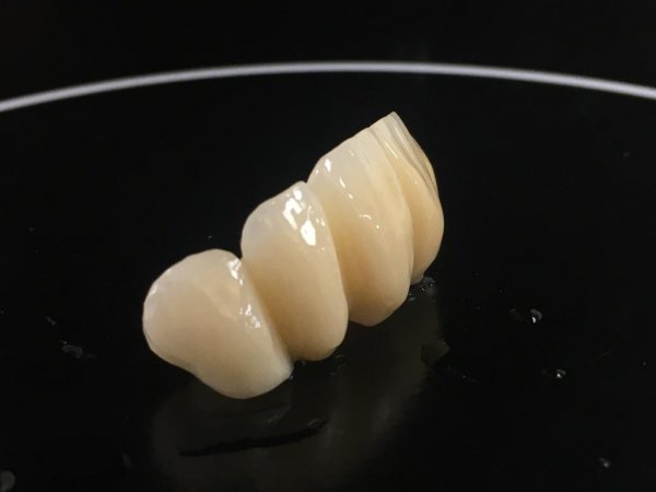 Provisórios (CAD/CAM) - Leme Laboratório