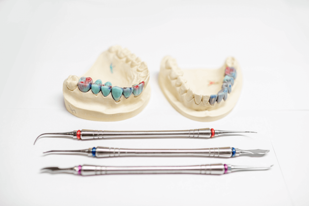 Quais são as indicações para inlay dental?
